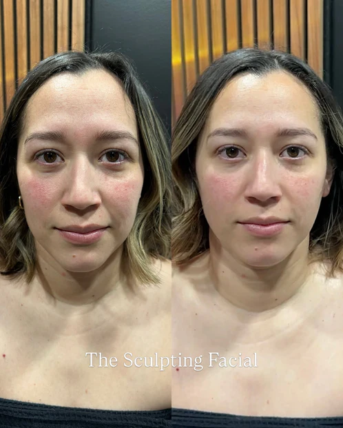 Before and after result 1