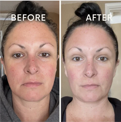 Before and after result 6